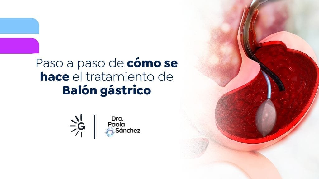 Dra. Paola Sánchez cuenta cómo se hace el balón gástrico en Bogotá, Colombia